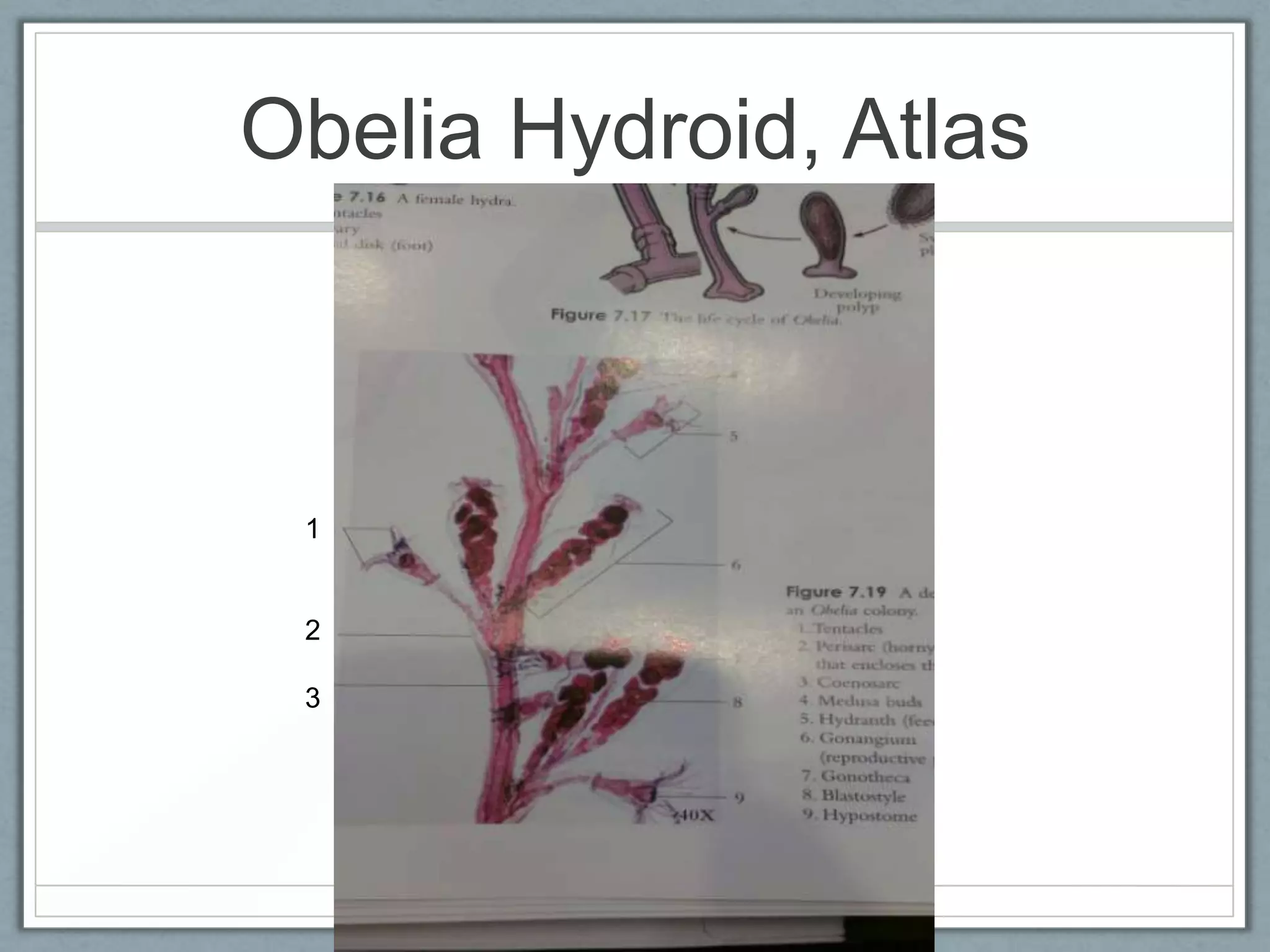 Obelia Hydroid, Atlas



 1


 2

 3
 