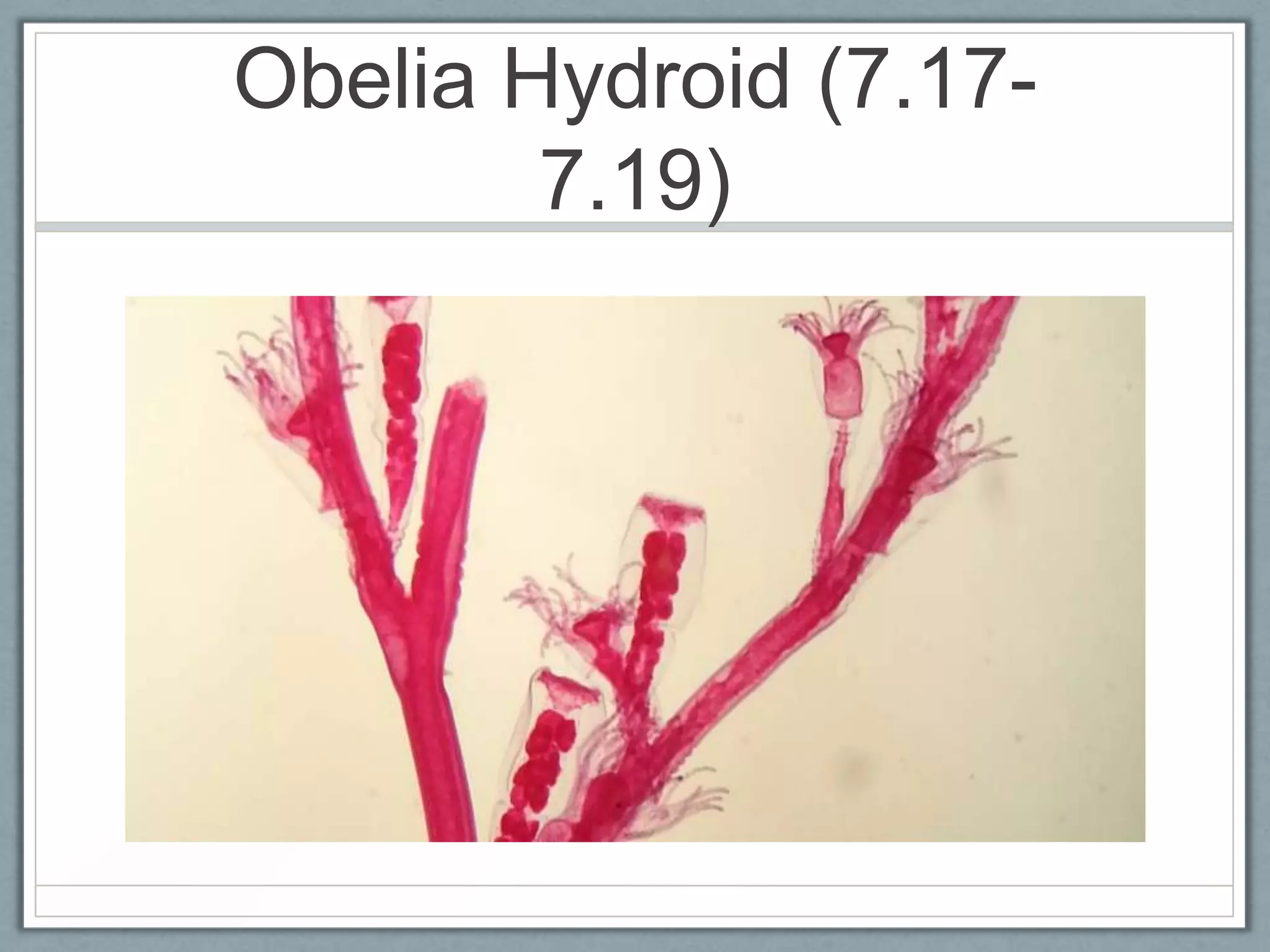 Obelia Hydroid (7.17-
        7.19)
 