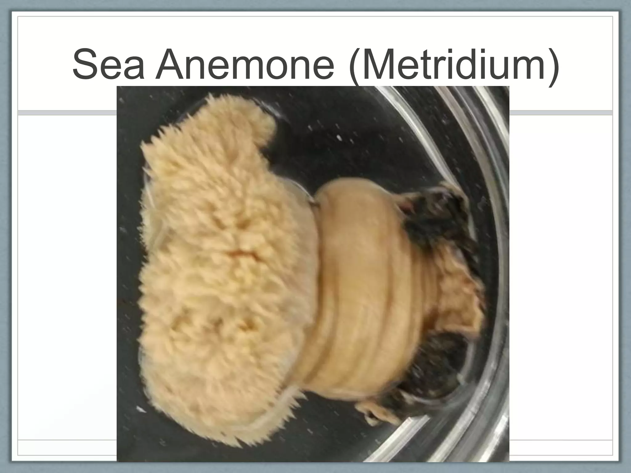 Sea Anemone (Metridium)
 