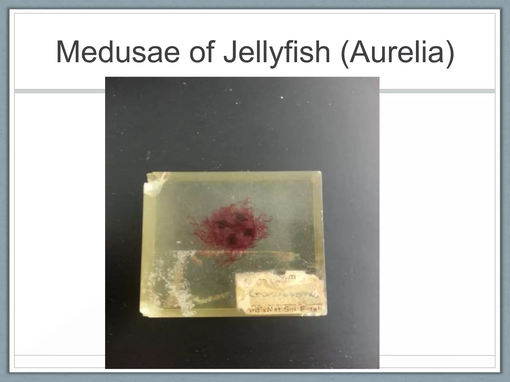Medusae of Jellyfish (Aurelia)
 