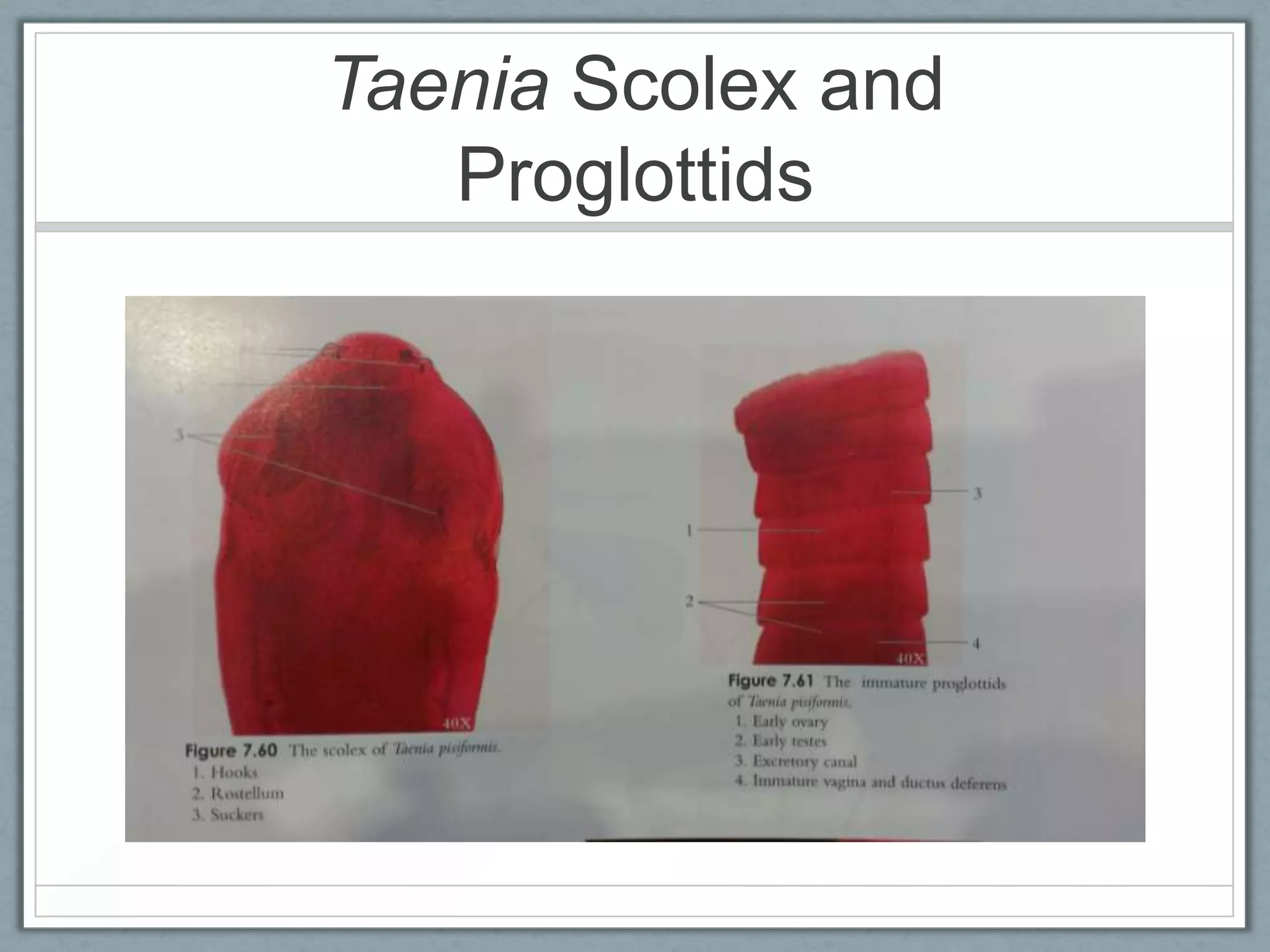 Taenia Scolex and
   Proglottids
 