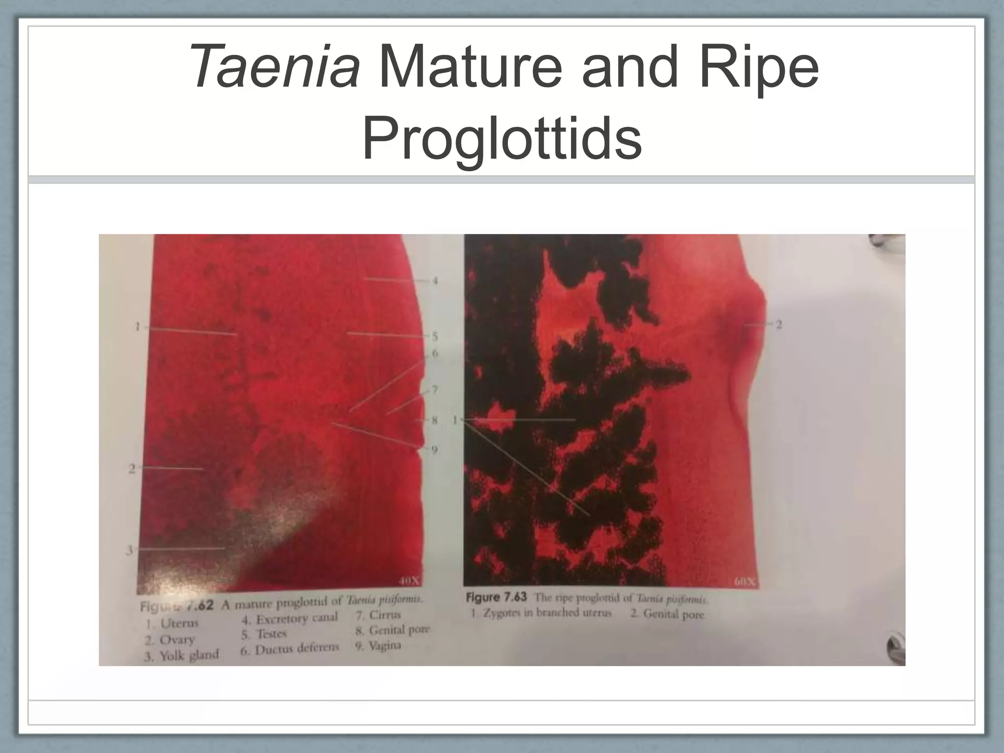 Taenia Mature and Ripe
      Proglottids
 