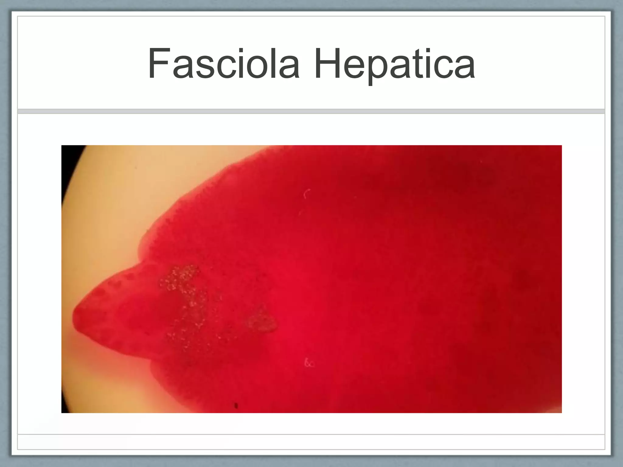 Fasciola Hepatica
 