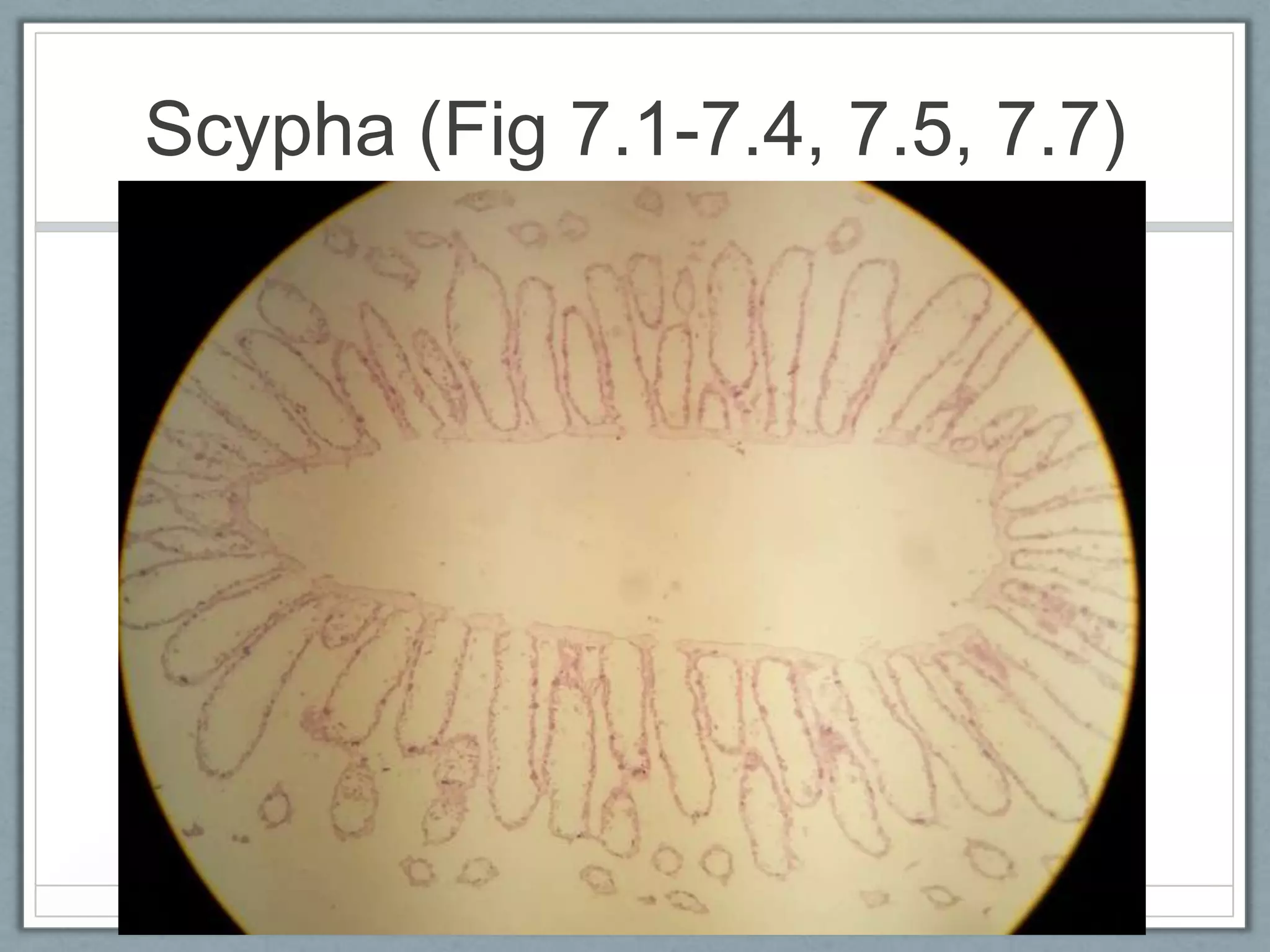 Scypha (Fig 7.1-7.4, 7.5, 7.7)
 