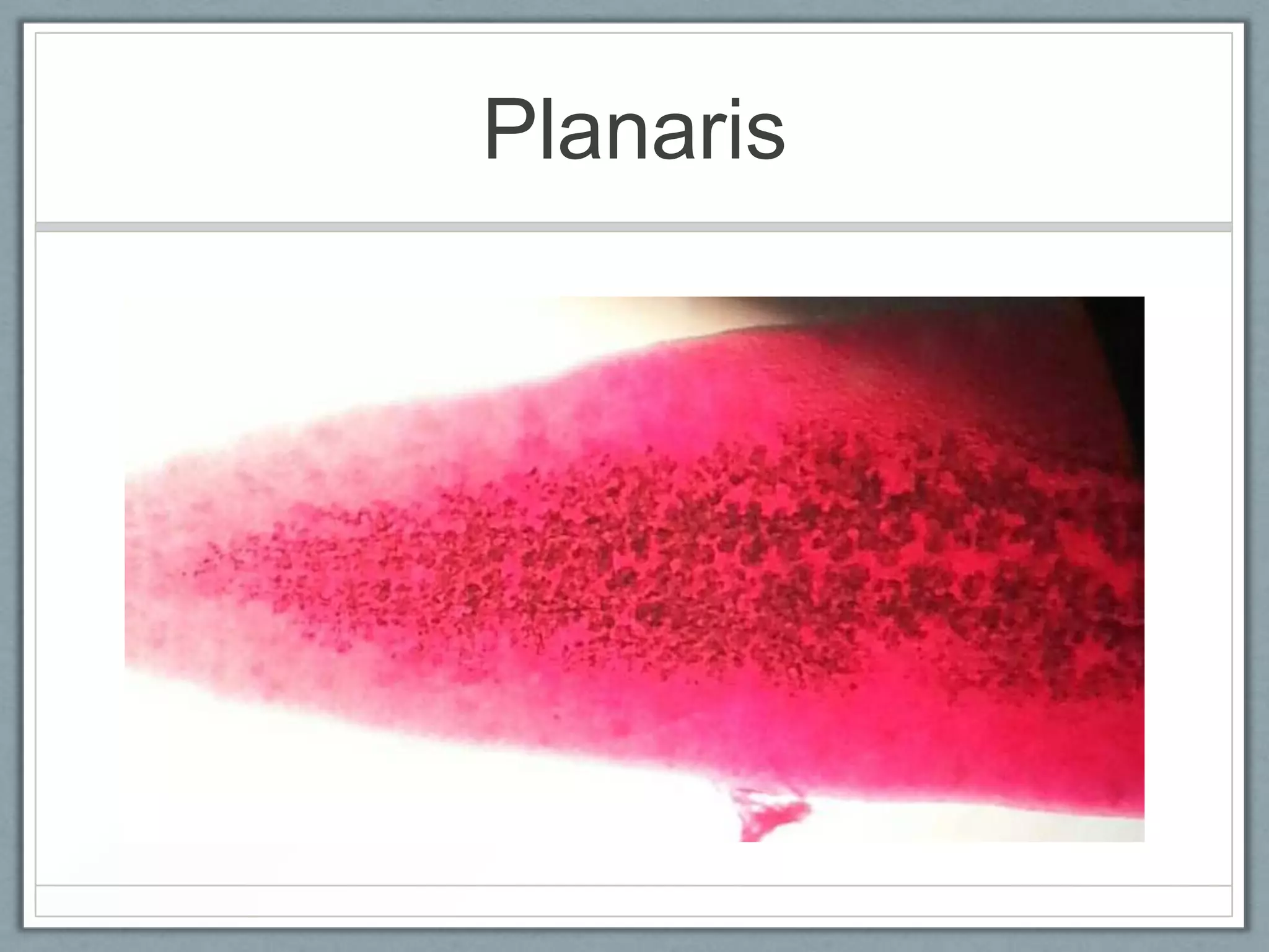 Planaris
 