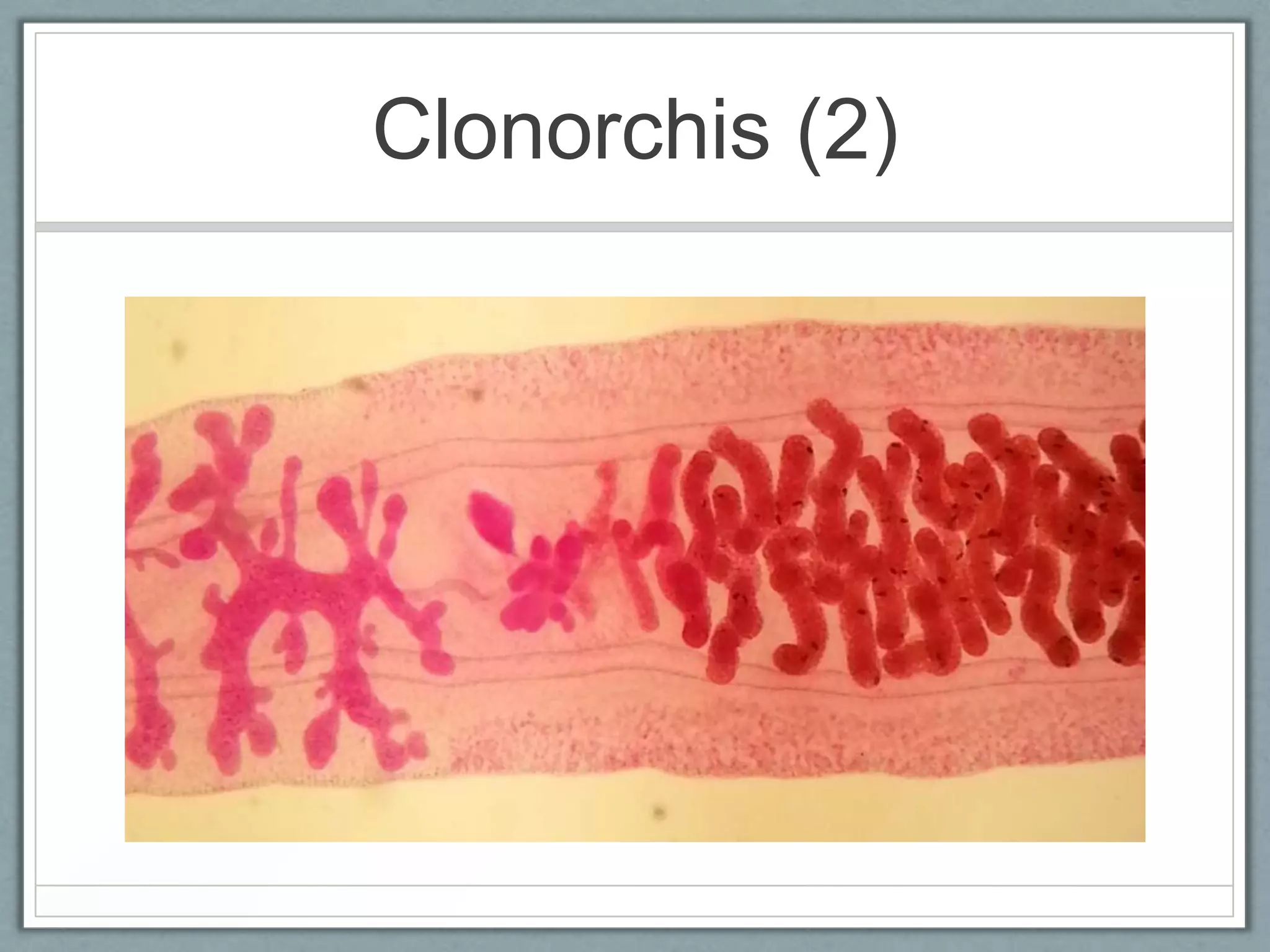 Clonorchis (2)
 