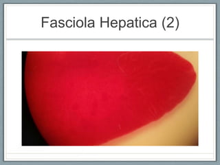 Fasciola Hepatica (2)
 