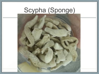 Scypha (Sponge)
 