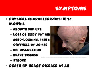 SYMPTOMS
• Physical Characteristics: 18-12
  months
  – Growth failure
  – Loss of body fat and hair
  – Aged-looking, thin skin
  – Stiffness of joints
  – Hip dislocation
  – Heart Disease Source: http://www.documentingreality.com/forum/f149/progeria-16225/
  – Stroke
• Death by heart disease at an
 