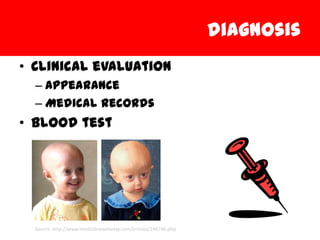 diagnosis
• Clinical evaluation
  – Appearance
  – Medical Records
• Blood test




  Source: http://www.medicalnewstoday.com/articles/146746.php
 