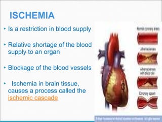  Is a restriction in blood supply
 Relative shortage of the blood
supply to an organ
 Blockage of the blood vessels
 Ischemia in brain tissue,
causes a process called the
ischemic cascade
 