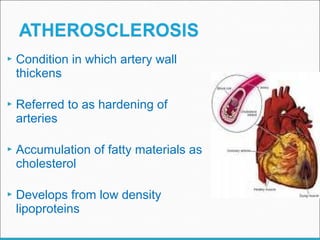  Condition in which artery wall
thickens
 Referred to as hardening of
arteries
 Accumulation of fatty materials as
cholesterol
 Develops from low density
lipoproteins
 