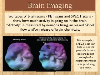 Brain Imaging
Two types of brain scans - PET scans and SPECT scans -
show how much activity is going on in the brain.
“Activity” is measured by neurons ﬁring, increased blood
ﬂow, and/or release of brain chemicals.
For example, a
SPECT scan can
help us see if a
person’s brain is
not producing
enough of a
neurotransmitter,
or is producing
too much.
 