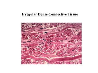 Irregular Dense Connective Tissue
 