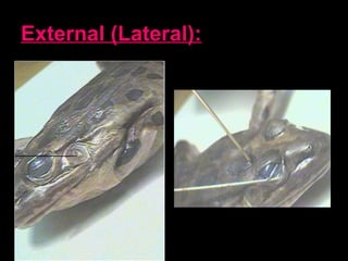 External (Lateral):