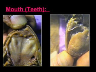 Mouth (Teeth):