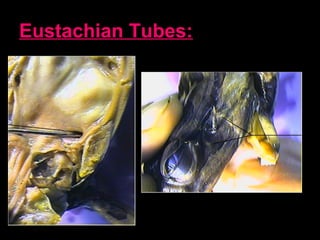 Eustachian Tubes: