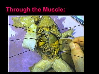 Through the Muscle:
