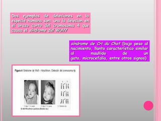 Dos ejemplos de deleciones en la
especie humana son: una la delecion en
el brazo corto del cromosoma 4 que
causa el síndrome del Wolff


                             síndrome de Cri du Chat (bajo peso al
                             nacimiento, llanto característico similar
                             al        maullido         de          un
                             gato, microcefalia, entre otros signos)
 