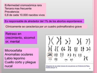 Enfermedad cromosómica rara
Tercera mas frecuente
Prevalencia:
0,8 de cada 10.000 nacidos vivos

Es responsable de alrededor del 1% de los abortos espontaneos
Clínicamente se caracteriza por un cuadro polimalforativo grave

Retraso en
crecimiento, sicomot
or, mental

Microcefalia
Anomalias oculares
Labio leporino
Cuello corto y pliegue
nucal
 