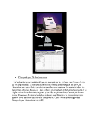 L'Imagerie par Bioluminescence

   La bioluminescence est étudiée en ce moment sur les cellues cancéreuses. Lors
de ces expériances, la luciférase est utilisé comme gène marqeur. En effet, la
dissémination des cellules cancéreuses est la cause majeure de mortalité chez les
personnes atteintes du cancer : des cellules se détachent de la tumeur primaire et se
déplace dans les vaisseaux sanguins pour aller se placer dans d'autres parties du
corps. Un cancer disséminé est plus résistant aux thérapies, la bioluminescence
permet alors de situer ces cellules cancéreuses. Cette technique est appellée
l'imagerie par bioluminescence (IB)
 
