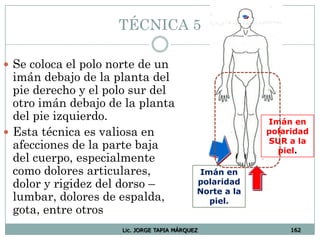 Lic. JORGE TAPIA MÁRQUEZ 162
TÉCNICA 5
 Se coloca el polo norte de un
imán debajo de la planta del
pie derecho y el polo sur del
otro imán debajo de la planta
del pie izquierdo.
 Esta técnica es valiosa en
afecciones de la parte baja
del cuerpo, especialmente
como dolores articulares,
dolor y rigidez del dorso –
lumbar, dolores de espalda,
gota, entre otros
Imán en
polaridad
Norte a la
piel.
Imán en
polaridad
SUR a la
piel.
 