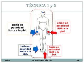 EMNSI Lic. JORGE TAPIA MÁRQUEZ 164
TÉCNICA 1 y 5
Imán en
polaridad
Norte a la
piel.
Imán en
polaridad
SUR a la
piel.
Imán en
polaridad
Norte a la piel.
Imán en
polaridad
SUR a la
piel.
 