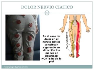 DOLOR NERVIO CIATICO
mnjorgetapia@yahoo.com.mx
169
En el caso de
dolor en el
nervio ciático
se colocan
siguiendo su
dirección los
imanes en
polaridad
NORTE hacia la
piel
 