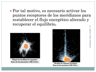  Por tal motivo, es necesario activar los
puntos receptores de los meridianos para
restablecer el flujo energético alterado y
recuperar el equilibrio.
69
Lic.JORGETAPIAMÁRQUEZ
 