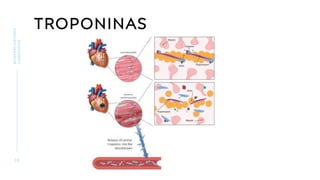 TROPONINAS
2 8
BIOMARCADORES
CARDÍACOS
 