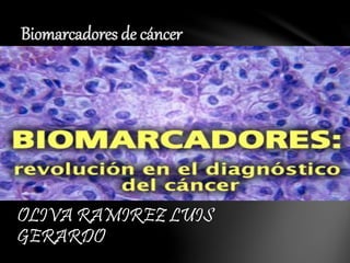 OLIVA RAMIREZ LUIS
GERARDO
Biomarcadores de cáncer
 