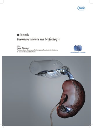 e-book

Biomarcadores na Nefrologia
Editor

Hugo Abensur

Professor Livre-Docente de Nefrologia da Faculdade de Medicina
da Universidade de São Paulo

 