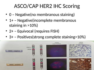 Comprehensive Overview of Biomarkers in Breast Carcinoma Diagnosis and ...