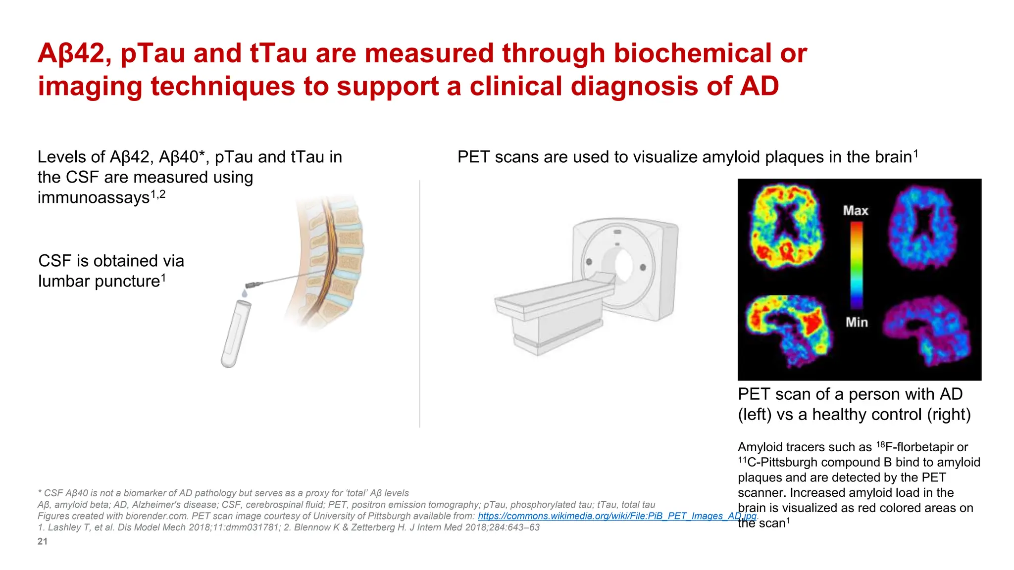 Role of Biomarkers in Alzheimers Disease | PPTX