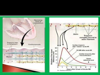 Biomarkers in Coronary Artery Disease | PDF