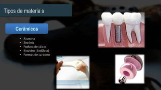 Tipos de materiais
• Alumina
• Zircônia
• Fosfato de cálcio
• Biovidro (BioGlass)
• Formas de carbono
 