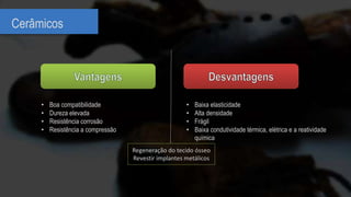 Cerâmicos
• Baixa elasticidade
• Alta densidade
• Frágil
• Baixa condutividade térmica, elétrica e a reatividade
química
• Boa compatibilidade
• Dureza elevada
• Resistência corrosão
• Resistência a compressão
Regeneração do tecido ósseo
Revestir implantes metálicos
 
