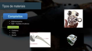 Tipos de materiais
• Carbono
• Vidro
• Kevlar
• Hidroxiapatita
• TCP – Fosfato tricálcico
 