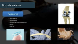 Tipos de materiais
• Poliuretano
• Polietileno
• Poli metacrilato de metila
• Nylon
• Dracon
 