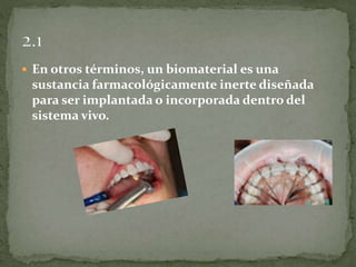 Biomateriales info-diapositivas-modificado | PPTX