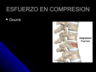 EESSFFUUEERRZZOO EENN CCOOMMPPRREESSIIOONN 
 OOccuurrrree 
 