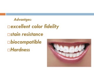 Orthodontic Brackets | PPTX