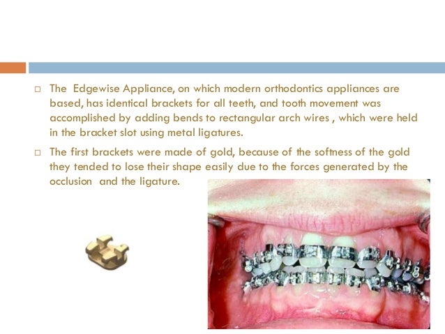 orthodontic brackets edgewise appliance