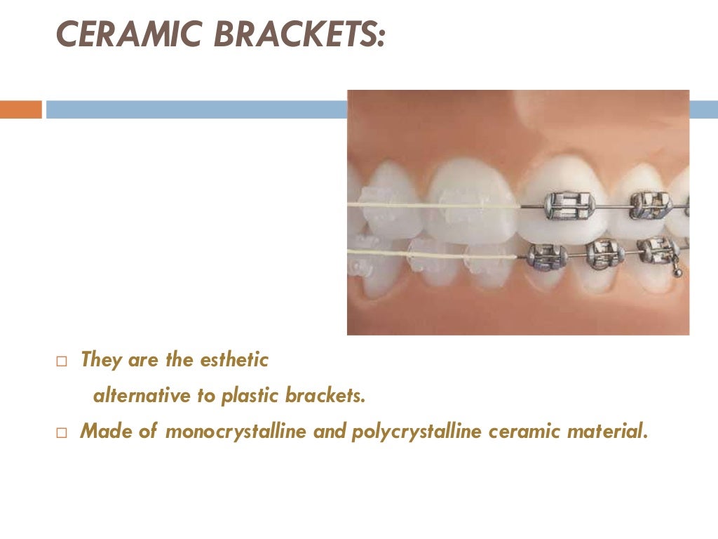 Orthodontic Brackets