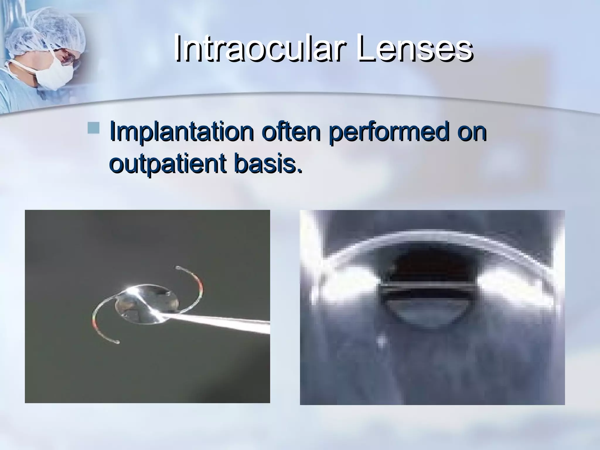 Intraocular LensesIntraocular Lenses
 Implantation often performed onImplantation often performed on
outpatient basis.outpatient basis.
 