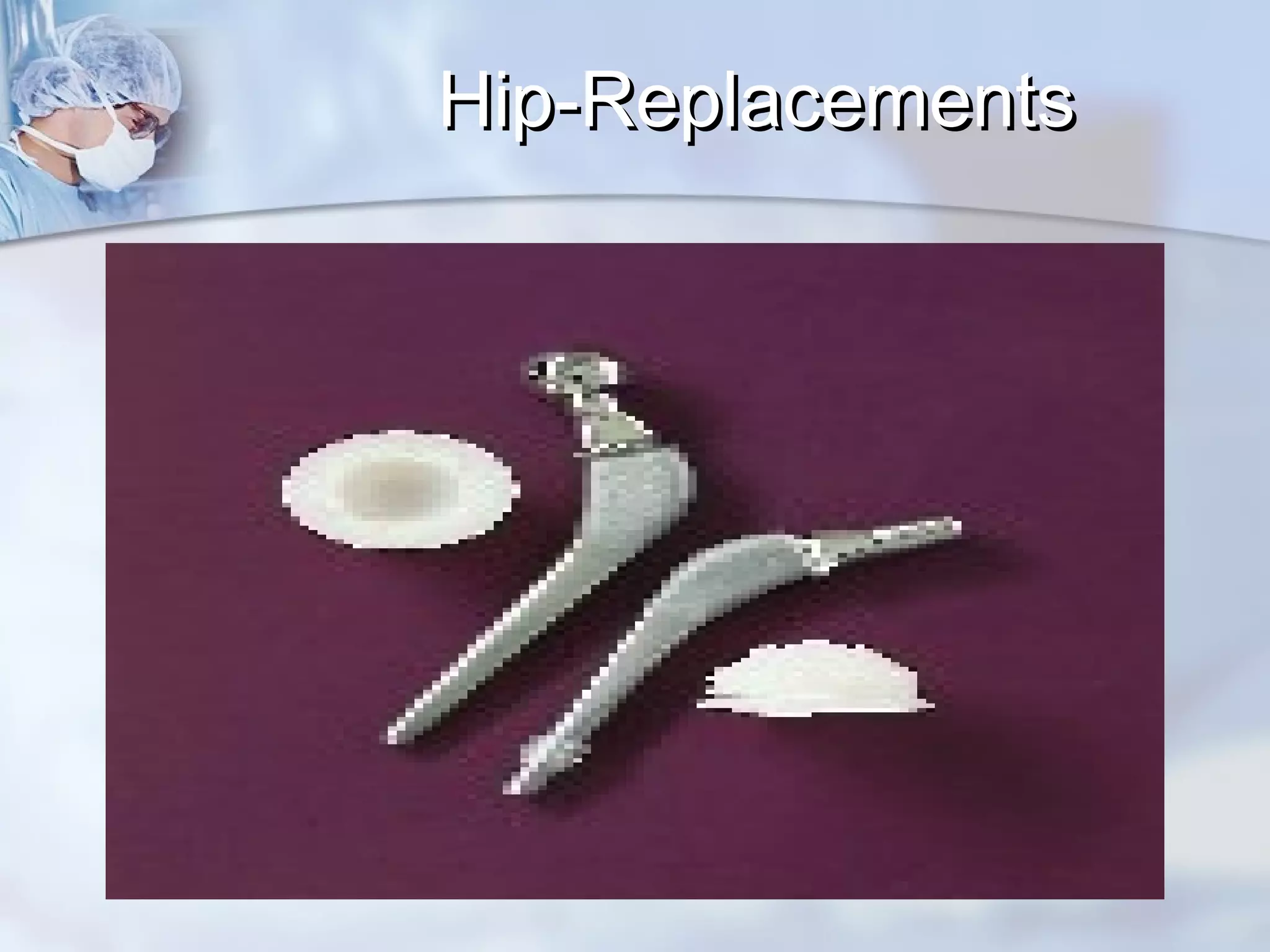 Hip-ReplacementsHip-Replacements
 