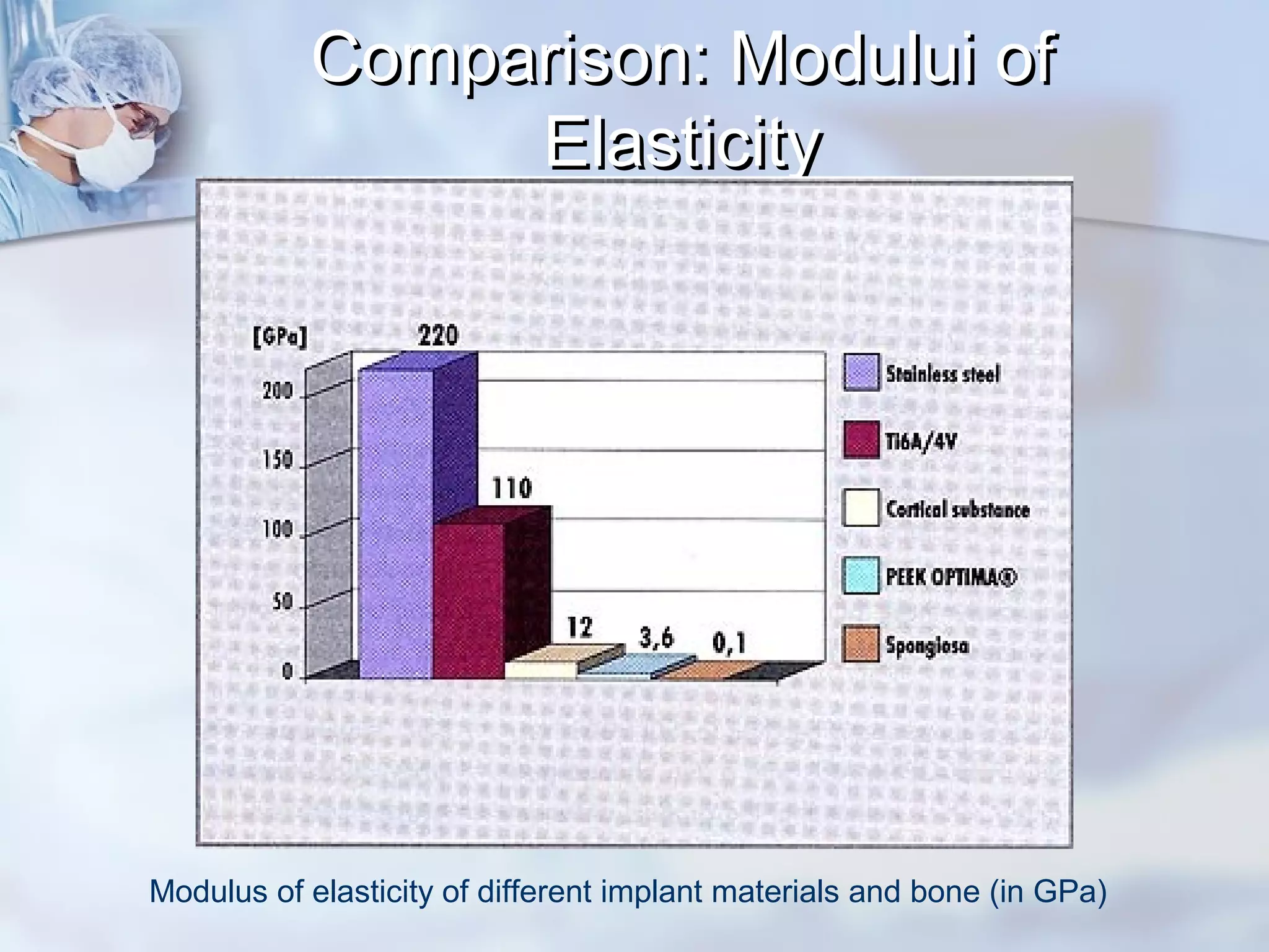 Comparison: Modului ofComparison: Modului of
ElasticityElasticity
Modulus of elasticity of different implant materials and bone (in GPa)
 