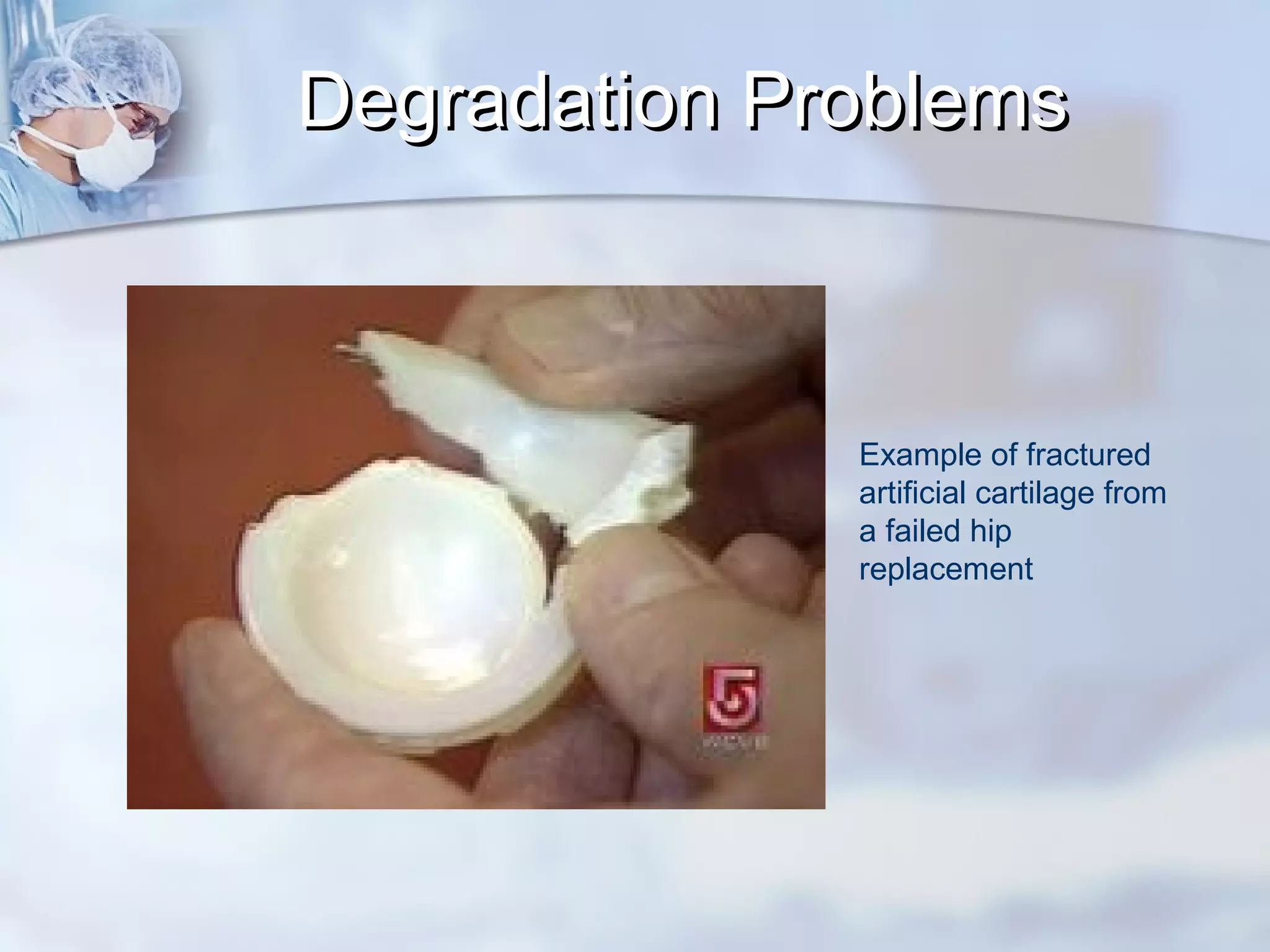 Degradation ProblemsDegradation Problems
Example of fractured
artificial cartilage from
a failed hip
replacement
 
