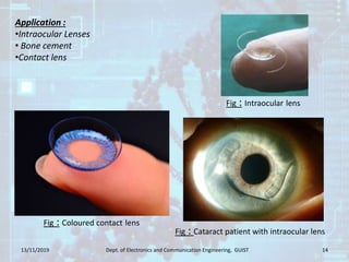 13/11/2019 Dept. of Electronics and Communication Engineering, GUIST 14
Fig : Intraocular lens
Application :
•Intraocular Lenses
• Bone cement
•Contact lens
Fig : Cataract patient with intraocular lens
Fig : Coloured contact lens
 