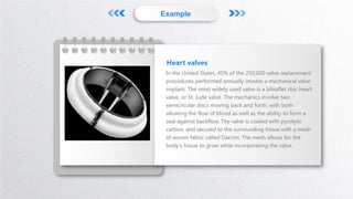 Example
In the United States, 45% of the 250,000 valve replacement
procedures performed annually involve a mechanical valve
implant. The most widely used valve is a bileaflet disc heart
valve, or St. Jude valve. The mechanics involve two
semicircular discs moving back and forth, with both
allowing the flow of blood as well as the ability to form a
seal against backflow. The valve is coated with pyrolytic
carbon, and secured to the surrounding tissue with a mesh
of woven fabric called Dacron. The mesh allows for the
body's tissue to grow while incorporating the valve.
Heart valves
 